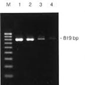 خالص سازی محصول PCR به ازای هر سمپل