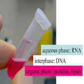Blood DNA Extraction kit 