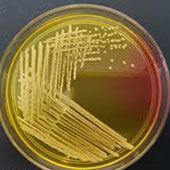 باکتری  E. coli DH5a  و پلاسمید PTG