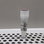 Reverse transcriptase MMLV