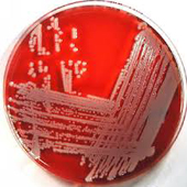 staphylococcus aureus